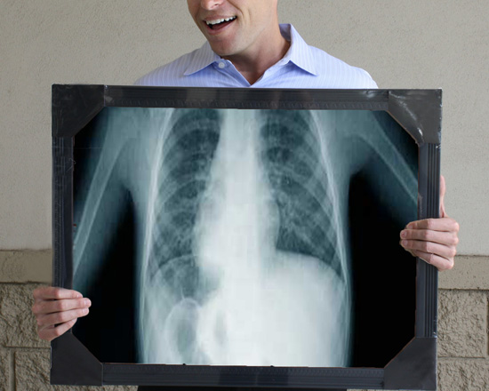 xray04_550.jpg